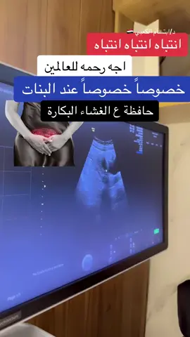 #دكتورة_ابتسام_الكعبي #مجمع_الدكتوره_ابتسام_الكعبي #تقنية #غشاء_البكارة_الأصلى #الفتاة #البنت #عقد_ليفية #اورام_ليفيه #اورام_الرحم 