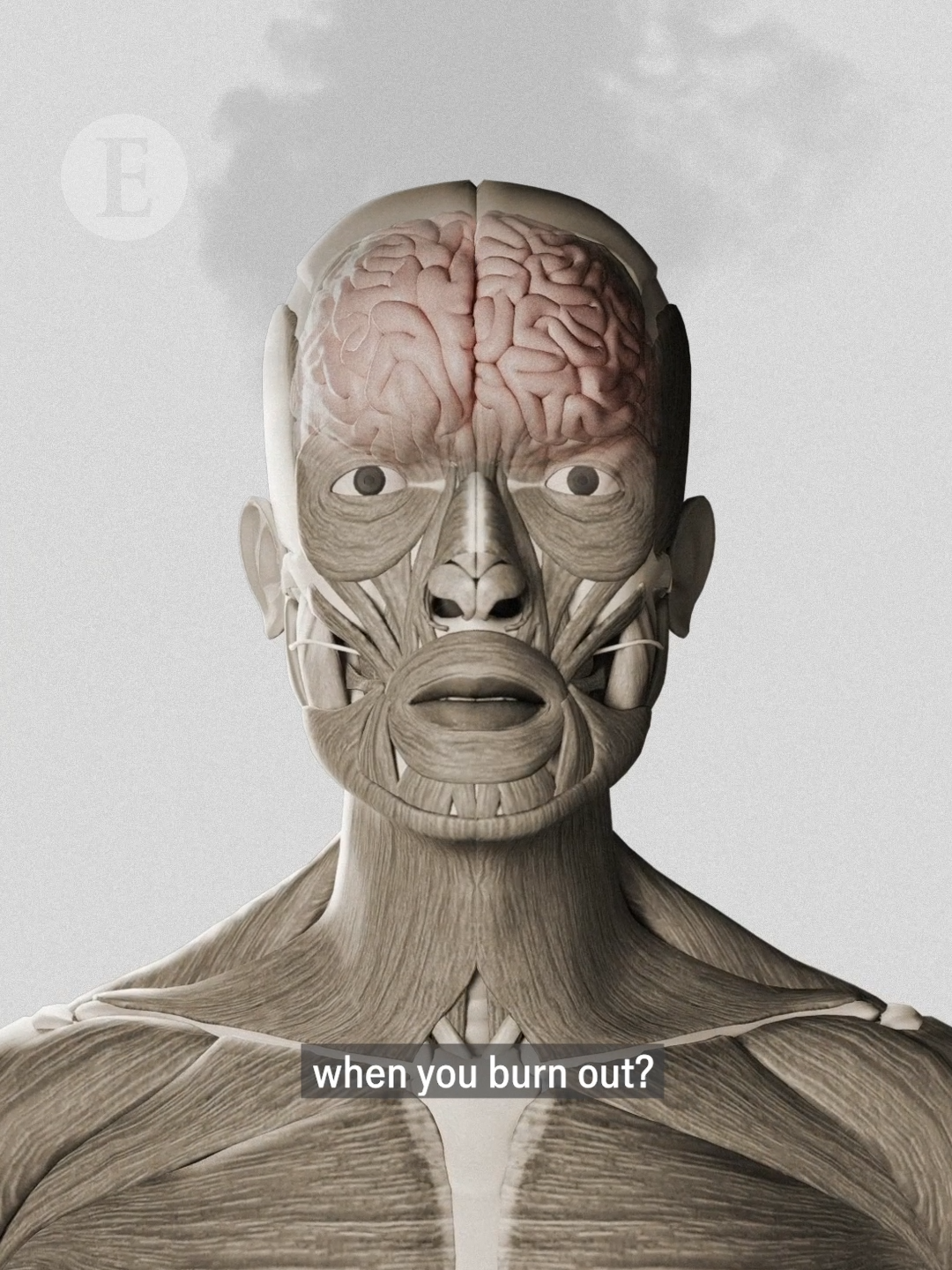 What happens to your brain when you burn out? This is the science behind thinking too hard #brain #science #biology #burnout #sciencetok #facts #learnontiktok #didyouknow 