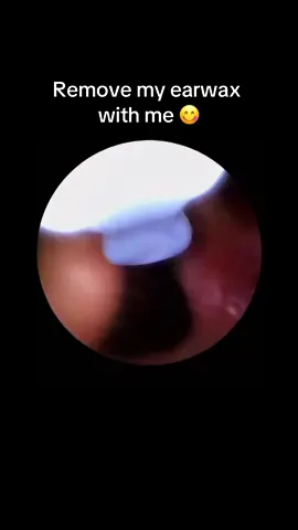 Would you try this? 🤪🤢