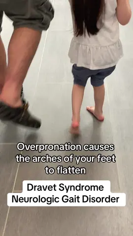 After a few months of wearing orthotics, Alina began walking up steps. Dravet syndrome needs a cure. #walking #gait #orthotics #pronation #dravetsyndrome #fyp #epilepsy #foryou #nocure 