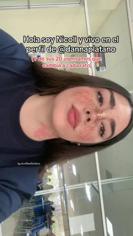 Ayúdenme a reportar esa cuenta porfa #tiktokvira #foryoupage #parati #fyp 