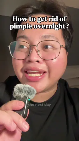 Here's how to get rid of a pimple overnight! 🤍