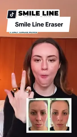 🌟✨ **Smile Line Eraser with Tongue Circles** ✨🌟 Reduce smile lines and improve facial muscle tone with this simple tongue exercise: 1. **Close Your Lips**: Keep your lips gently closed. 2. **Tongue Circles**: Place your tongue against the inside of your cheek and make slow, circular motions along the inside of your lips. Move your tongue in one direction for 10 circles, then switch to the opposite direction for another 10 circles. 3. **Repeat**: Do this exercise twice a day for best results. This exercise helps to strengthen and tone the muscles around your mouth, reducing the appearance of smile lines over time. 🌿💆‍♀️ #SmileLineEraser #TongueCircles #FaceYoga #AllYouCanFace 