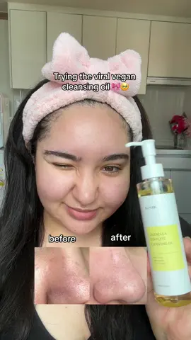 definitely a yes 🥹  - Perfect for sensitive / acne prone skin  - Would definitely repurchase  @iUNIK @iunik_us_official 🩵💙 #iunik #iunikskincare #iunikcleansingoil #beginnerskincare #calendulacleansingoil #cleansingoil #glassskin #iunik30secondchallenge #kbeauty #koreanskincare #recommendations #acne #makeup #oilcleansing #doublecleansing 