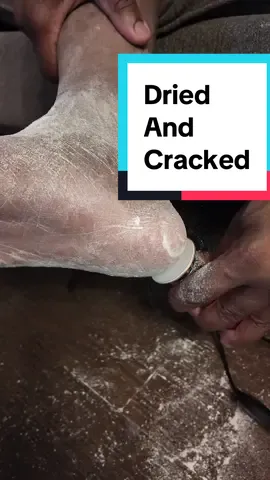 My feet feel smooth as slik!  This really works! Sanding my heel with this electric foot file has been so relaxing satisfying and gross. 🤣 But the reward of baby bottom feet is priceless!!! 😍 #footfile #sanding #pedicure #toes #feetcare