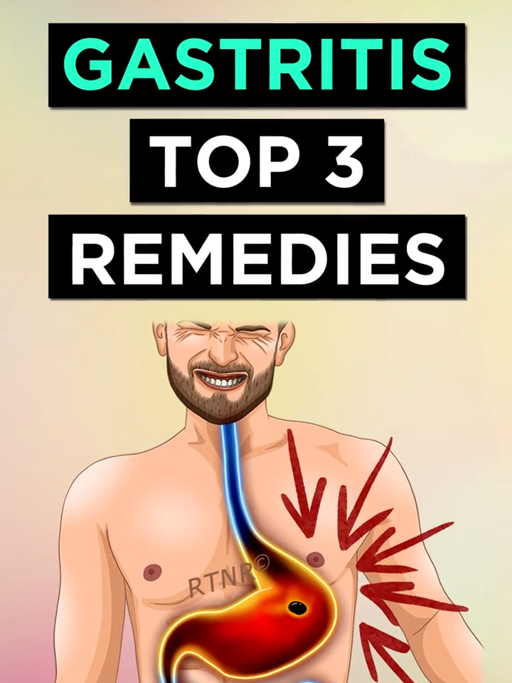 Top 3 Natural Remedies For Gastritis #gastritis #stomachulcer #stomachproblems #remediesforgastris #healstomach #stomachremedies #acid #ulcers #reflux #naturalremedies #ryantaylornatuarlremedies