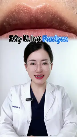 Hạt Fordyce  #bsnhungdalieu #belanifordyce #belani #thammoi