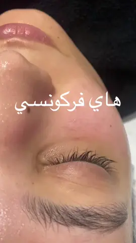 مرحبا بيكم ناس فاس promotion fsoin hydrafcail #hydrafacial #soinvisage #foryou #fes 