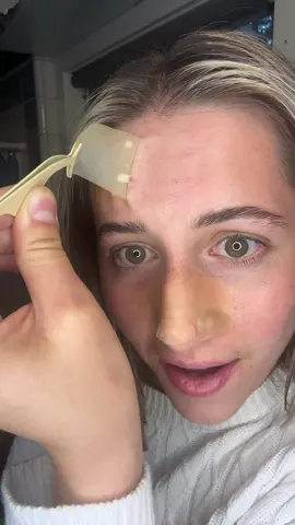 MOST SATISFYING RESULTS EVER😍 with my favorite hydrocolloid patches (these are called Peace Out Pores from @PeaceOutSkincare) #porestrips #pimplepatch #pimplepatchresults #pimple #pimples #skincare #peaceoutskincare #hydrocolloidbandages #hydrocolloidpatches 