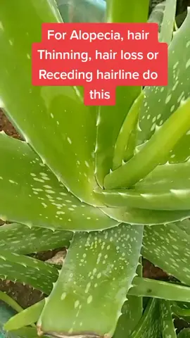 Hair Loss treatment remedy you need to know. #remedy #herbalbooks #hairloss #alopecia #herbs #herbal #herbalbooks #hairthinning #viral #foryou #fyp #onthisday 