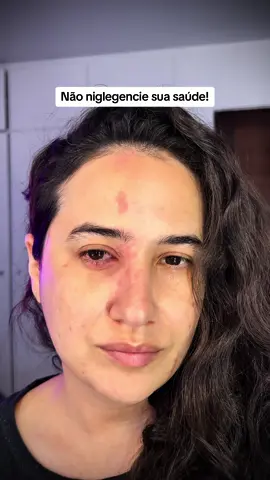 Cuide da sua saude! #drathaisapereira #herpes #herpeszoster #herpeszostervirus #sinusite #olho #infeccao #inflamacao 