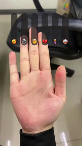 Omg !! 😳😱😲 #fyp 