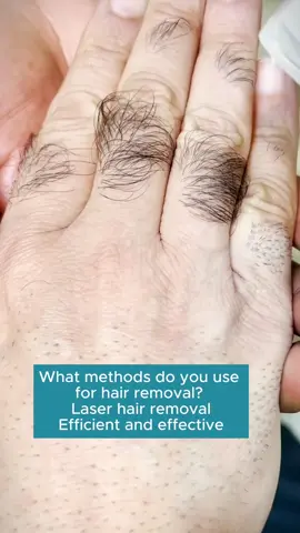 Laser hair removal #Laserhairremoval #fyp #ipl #laserhairremovaltreatment #lasertattooremoval #hairremoval #waxing 