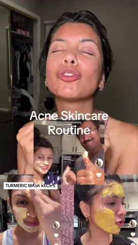 Acne Skincare Routine 🧴🤍  Ignore my hair mask Turmeric Face Mask Benefits for Acne-Prone Skin: - Reduces inflammation and redness - Fights acne-causing bacteria - Helps to fade acne scars - Provides a natural glow to the skin Rice Mask Benefits for Acne-Prone Skin: - Absorbs excess oil and controls sebum production - Gently exfoliates the skin, removing dead skin cells - Soothes and calms irritated skin - Brightens and evens out skin tone Rice Water Benefits for Acne-Prone Skin: - Acts as a natural toner, tightening pores - Helps to reduce acne and breakouts - Hydrates and moisturizes the skin - Improves skin texture and elasticity Rice Paper Benefits for Acne-Prone Skin: - Absorbs excess oil and shine from the skin - Provides a mattifying effect - Helps to control sebum production - Can be used as a blotting paper to freshen up the skin throughout the day #Skincare #koreanbeauty #acne #kbeauty #skintok #pores #cloggedpores #skincareroutine #creatorsearchinsights 