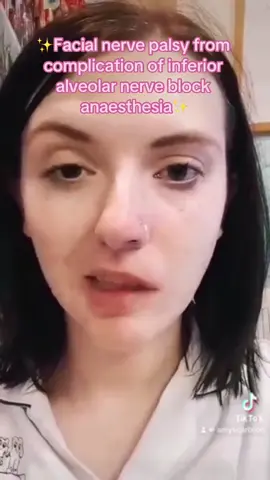 ✨Complications from LA✨ #dentalnurse #dental #dentalassistant #dentist #dentalimplants #dentalcare #dentalhygiene #dentalclinic #nurse #oralhealth #oralhygiene #oralcare #dentalhumor #dentisthumor #rdn #dentalhealth #dentist #nhs #privatepractice #nhspractice 