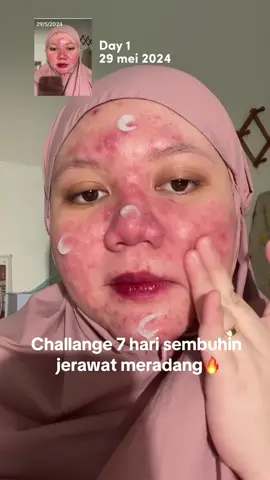 Challange pake moist G2G si ungu ini, hasilnya mantep bangettt 🥹🫵🏻 #fyp #moisturizer 
