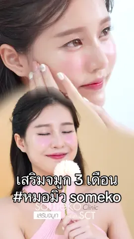 เสริมจมูก หมอมิว 3เดือน ปรับโหงวเฮ้งให้ใบหน้าดูหวานละมุนขึ้น อย่างเป็นธรรมชาติ!!! #หมอมิวsomeko #สวยปังไม่พังแน่นอน #เสริมจมูกSomeko #someko #somekoclinic #เสริมจมูก #แก้จมูก #รีวิวจมูก #ศัลยกรรมจมูก #rhinoplasty #revisionrhinoplasty #nosesurgery #surgerythailand #rhinoplastysomeko 