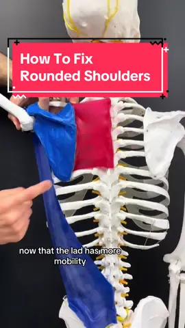 PART 1: Do you have rounded shoulders? Typically along with this you may notice your head comes forward or your back is a little hunched. Maybe you also experienced neck tension, headaches or jaw pain? But then again, you don’t have to experience any of that, but you can still have rounded shoulders. Some people want to get out of pain while others just want to look normal and not like a gorilla.