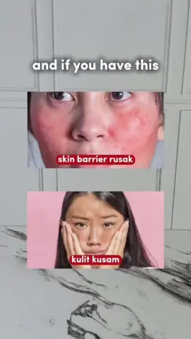 Gunakan produk sesuai kubutuhan kulit kamu ya bestie... #lipcaresr12 #ceramidesr12 #retinolsr12 #acnecreamsr12