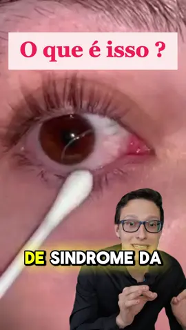 Sindrome da Pesca de Muco #saude #enfermagem #medicina #curiosidades 