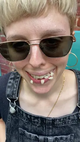 Can You Really Have EXTRA Teeth?! 😳🦷 #teeth #mouth #dentist 