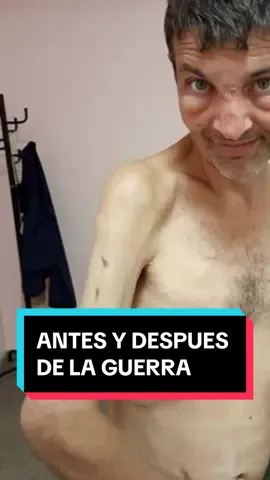 Soldados ucranianos ANTES y DESPUES de la GUERRA #fyp #foryou #julianabdala #persona #paratii #misterio #mistery #fypシ #horror #personas 