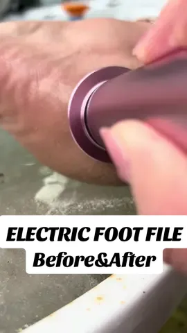 Really cracked and rough feet run in my family so bad! As soon as I saw this foot file online, I knew I had to try it out! Thank you to one of my cousins for helping me review this for for the first time! Such an improvement after only one use! #electricfootfile #productreview #crackedheelstreatment #beforeandafter