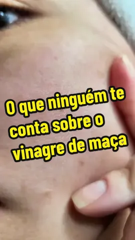 @Andreza Oshiro  A verdade sobre o uso de vinagre se maçã no rosto que ninguem te conta #vinagredemanzana #pelebonita #brasileironojapao🇧🇷🇯🇵 #brasileirospelomundo #produtos #japao #brasil🇧🇷 #minhavidanojapao #boramonetizar 