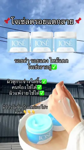 ตอนนี้จัดโปรอยู่รีบตำเลยค่าบบ #โจเซ่ลดรอยแตก #โจเซ่ไวท์พลัส #jose #ครีมลดรอยแตกลาย #คนท้องใช้ได้ 