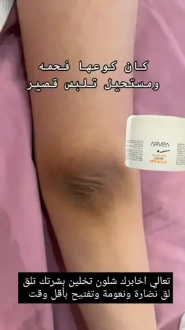 كريم المعجزة 💛💛 مركز ترطيب حقيقي غني بالألوة فيرا وزيت الأرغان وزبدة الشيا وزيت بذور العنب وبروفيتامين B5 والبابونج وآذريون. توفر هذه التركيبة الاستثنائية للبشرة راحة مطلقة ورطيبا دقيقا يستمر لمدة 24 ساعة. بفضل نسيجه الكريمي الخفيف، يتم امتصاص الكريم المعجزة بسرعة، مما يترك البشرة مرنة ورطبة. مصمم للجسم، ويمكن استخدامه أيضا ككريم لليدين والقدمين. كريم المعجزة مناسب لكل من الرجال والنساء✨ #arvea #كريم_ترطيب #كريم_ترطيب_الجسم #كريم_ترطيب_الوجه #كريمات_تفتيح #بوفيهات #بوفيهات_الكويت #معطم #شيلات #اكل_صحي #بوفيهات_استقبال #بوفيه #بوفية #بوفيهات #الكويتيات #مطبخ #اكلات_لذيذه#العيد_الوطني_الكويتي #عروض #الكويت🇰🇼 #بوفيهات_الكويت #بوفيهات_الكويت#بوفيهات_أفراح #بوفيهات_مفتوحه #اكل #بوفيه_راقي #الكويتkuwait #الكويت_الفحاحيل_الفنطاس_مبارك_الكبير_العديلية_ام_الهيمان_الاندلس_الجهر #الكويت_اليوم #سخانات_بوفيه #سخانات #سخانات_طعام #بوفيهات_الكويت #الكويت🇰🇼 