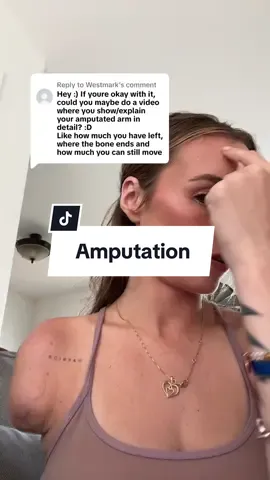 Replying to @Westmark here’s a little about my amputation. I don’t really talk about what happened how it happened where it happened or anything like that on here but if you’d like to know more, I am happy to make videos about it! 🦾 #amputee #amputeelife #amputation #caraccident #scars #onearm #limbloss #amputeetiktok #fyp 