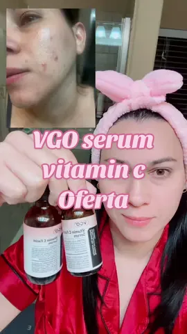#vgo #serumviral #tiktokshopsummersale 