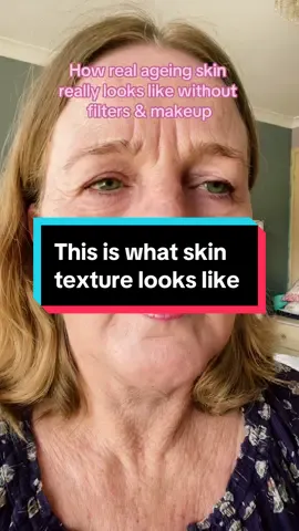 At age 57 next month let’s not forget what our skin texture looks like. We see too many flawless, filtered faces nowadays. However embrace your own skin texture, every line or wrinkle has a story behind them- some sad and some happy. Growing old is a privilege these days- not many will reach my age which includes 3 of my besties who didn’t have the opportunity to get over 40.  #skintexture #skinstory #wrinkles #finelines #ageisaprivilege 
