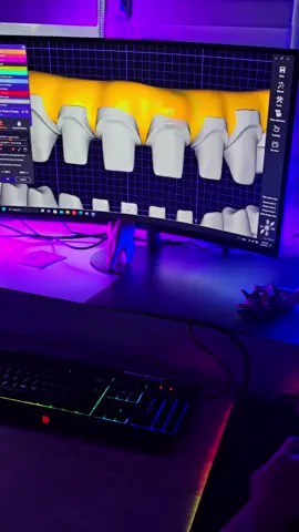 #dentallx #dentallaboratory #dentaltechnician #dentistry #dental #exocad #thimble #fy #fyp 