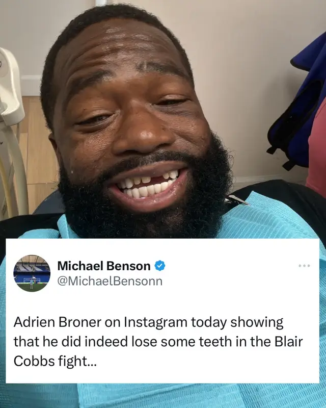 AB on instagram today confirming he lost a tooth in the Cobbs fight 👀 #adrienbroner #boxingtok #boxing 