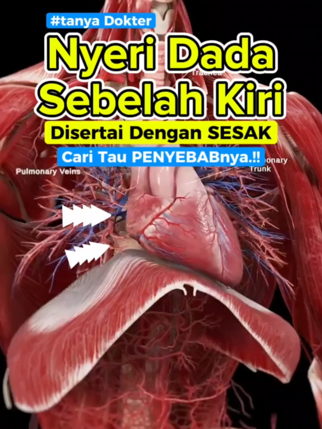 Nyeri Dada Sebelah Kiri Disertai Dengan Sesak #nyeridadakiri#nyeridada #sesak #sesaknafas #jantung #jantungsehat #kesehatan #sakitjantung #tipskesehatan
