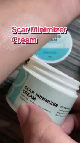 Replying to @joyceannamargo effective cream for peklat ❤️ Must try! #peklatcream #clarityessentialsscarminimizercream #scarcream #scareliminatorcream #peklatnomore 
