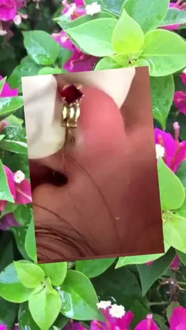 #squeeze #squeezeyuk #acne #pimple #pimplepop #blackhead #satisfying #foryoupage