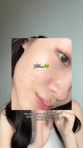 it’s soo tiring juggling work & uni full time, trying my best to heal my damaged skin barrier! 🥹 niacinamide is well known in treating dark spots & acne marks, worth a try! 🎀💗 product: Skintific MSH Niacinamide Brightening Moisture Gel #skintific #skintificmy #skintificniacinamidemoisturizer #moisturizer #skincare #malaysia #fyp 