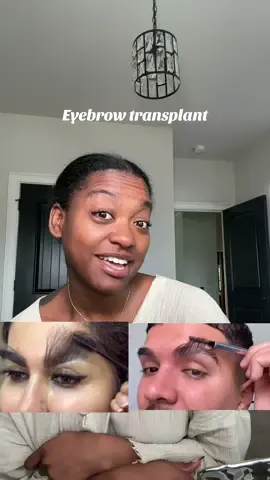Have you ever heard of an eyebrow transplant? I am so fascinated by this procedure. #eyebrowtransplant #thickbrows #brows 