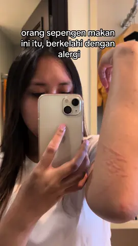 makan alergi, minum alergi, dingin alergi, panas alergi, umbar janji alergi, ngomong doang alergi, tp ini bkn tentang alergi
