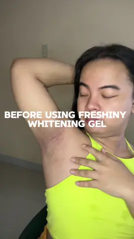 go na bash na “ang itim”, “ang asim” go na nahiya pa pero bili na kayo buy 1 take 1 yan gew! #freshinyunderarmgel 