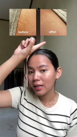 seneng banget stretchmark aku memudar walaupun belum 100% tp udah bersyukur bgt  #stretchmark @Ciara Indonesia  