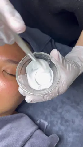 Lại là U trắng AHOWa#xuhuongtiktok #làm_đẹp_mỗi_ngày #peel_trị_mụn_thâm_image #thu_nhỏ_chân_lông #cấy_trăng_quin #thu_nhỏ_chân_lông 