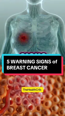 5 WARNING SIGNS of BREAST CANCER #BreastCancerAwareness#breastcancer#breastcancerwarrior💕 