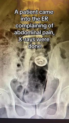 Ouch 😂🤷🏻‍♀️🤦🏻‍♀️💀 #xraytechs #xray #humor #ER #foryou #funnystories #funnyfaces #foryoupage #medicaltiktok #fyp #viraltiktok #menbelike #lmfao #jokes #facts 💯