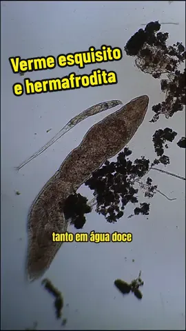 Neste vídeo, exploramos o fascinante mundo do Macrostomum, um pequeno verme plano que habita ambientes aquáticos. Descubra como esses platelmintos desempenham um importante papel na decomposição de matéria orgânica e na manutenção da saúde dos ecossistemas. Com um corpo transparente que revela seus órgãos internos, o Macrostomum nos mostra sua incrível adaptabilidade e capacidade de regeneração. Assista para saber mais sobre sua alimentação variada e seu sistema reprodutivo hermafrodita. Curta, comente e compartilhe esse vídeo para que mais pessoas conheçam o incrível mundo microscópico! #microbiologia #microscopico #microorganismos #curiosidades #platelminto 