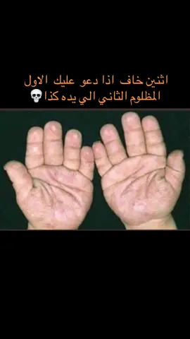 #f #fyp #foryou #fypシ゚viral #الشعب_الصيني_ماله_حل😂😂 #مالي_خلق_احط_هاشتاقات🧢 #explore #رياكشن #ضحك #ترند 