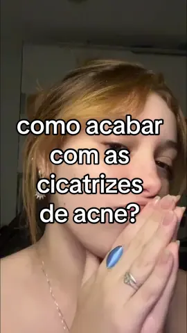 calma tik tok é so um tomara que caia  tags: #fyp #fypage #foryou #foryoupage #acne #skincare #rotinadeskincare #cuidadoscomapele #cosmeticos #skintok #clearskin #roacutan #cicatriz #cicatrizdeacne