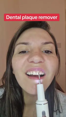 dental plaque remover, removes stains or tartar, inteligent ultrasonic dental scaler. #tiktokshop #tiktokmademebuyit#dentalplagueremoval #dentalhygienist #dentalcleaning #dentalcleaninggadget 
